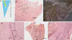 Characterization of regional meniscal cell and chondrocyte phenotypes and chondrogenic differentiation with histological analysis in osteoarthritic donor-matched tissues